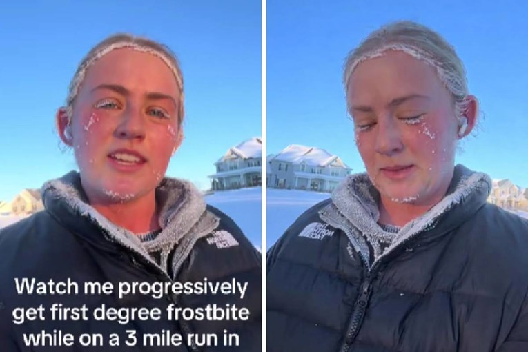 Pokazala je što joj se dogodilo tijekom trčanja na -22°C: "Morala sam na hitnu"
