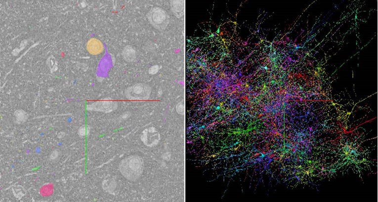 Google mapirao dio ljudskog mozga do najsitnijih detalja