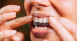 Što učiniti ako ste predugo držali trake za izbjeljivanje zubi?