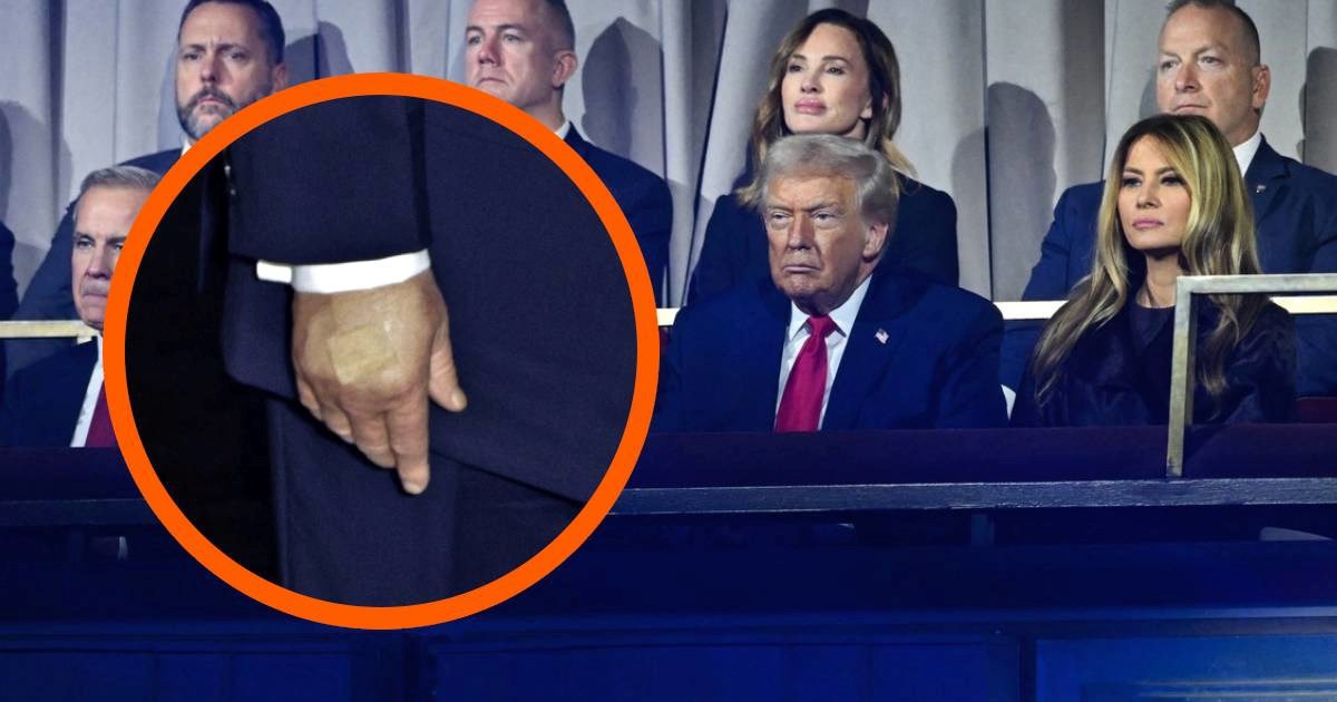 Trump i Melania na ždrijebu za SP 2026. On ima flaster na ruci, dobio nagradu za mir