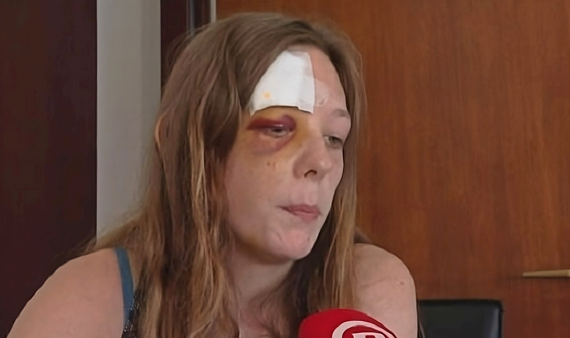 Miju (25) je brutalno istukao najmodavac: "Tražila sam polog, izvadio je palicu..."