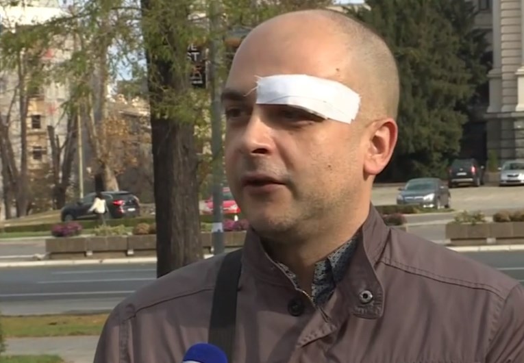 Muškarca u centru Beograda napali zbog ružičaste torbe, mislili da je gej