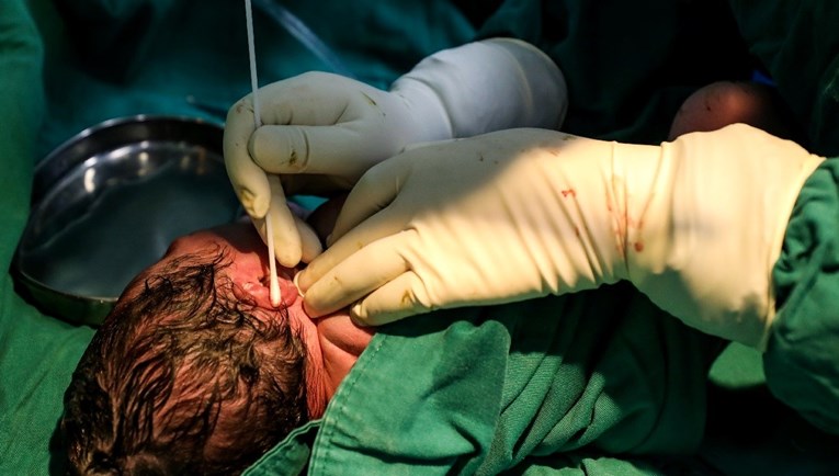 Nizozemski ginekolog tajno plodio pacijentice, napravio je najmanje 17-ero djece