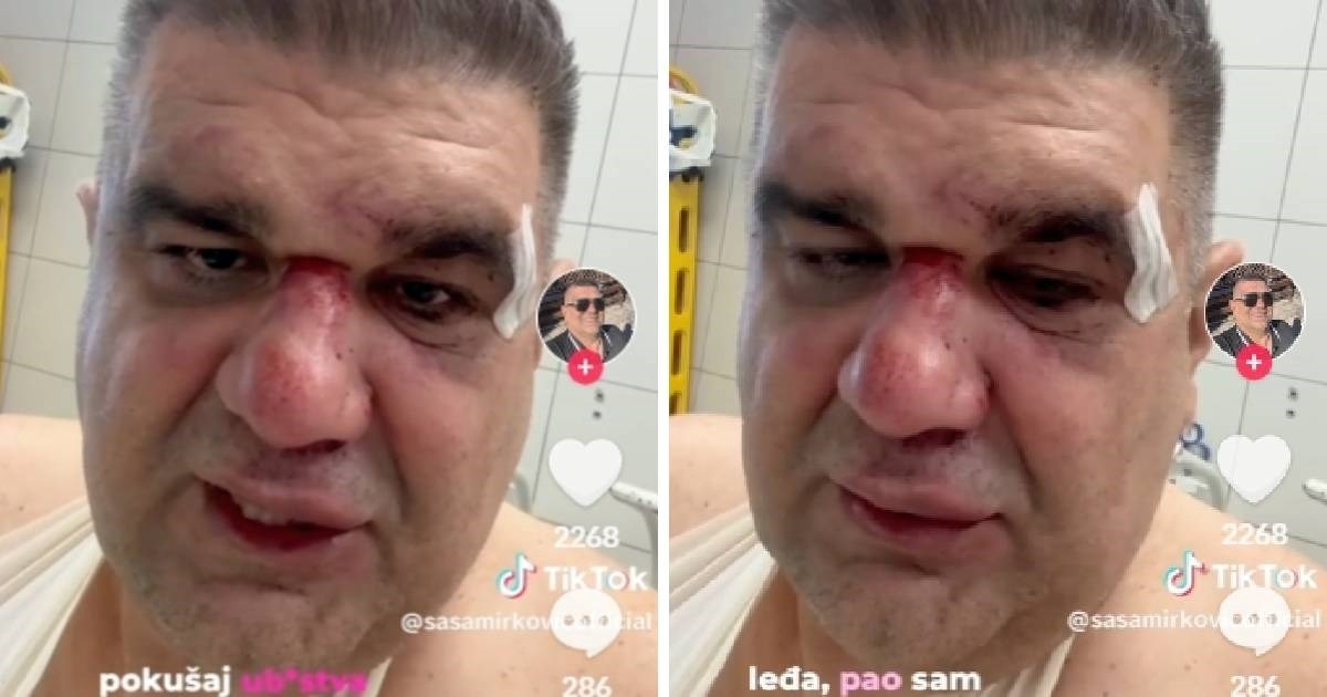 Javio se prebijeni srpski poduzetnik. "Šutirao me u glavu, slomio ruku na tri mjesta"