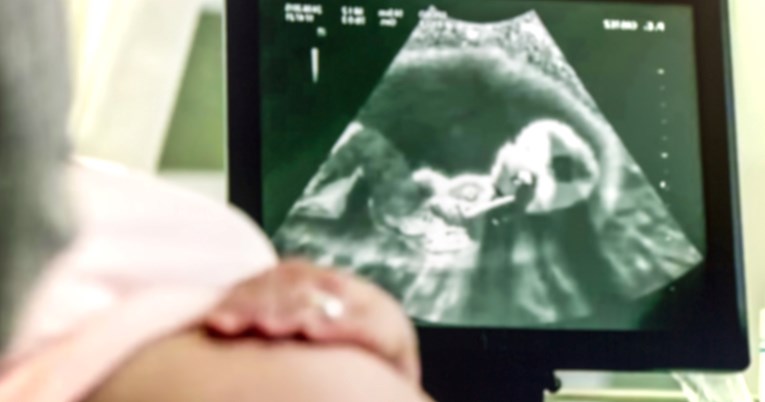 Umjetna inteligencija mogla bi točno predvidjeti dan rođenja djeteta