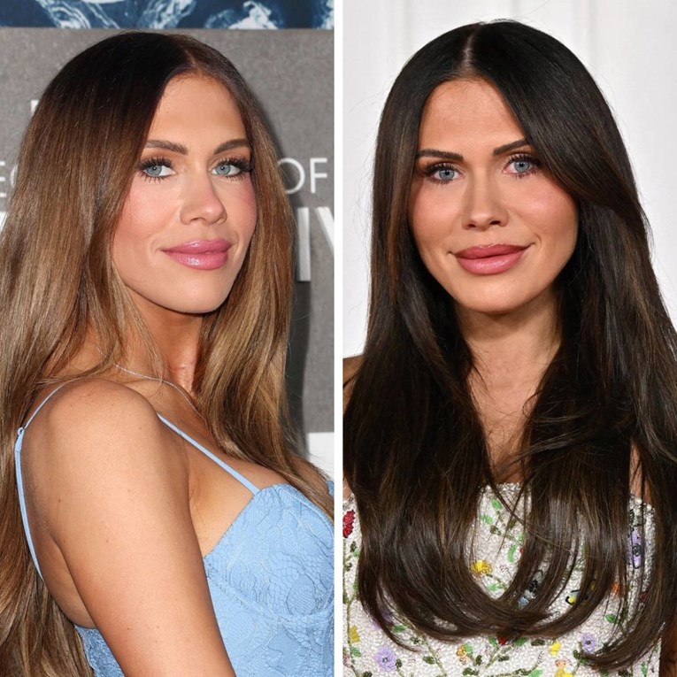 Reality zvijezda: "Estetska operacija od 23.000 eura uništila mi je život i karijeru"