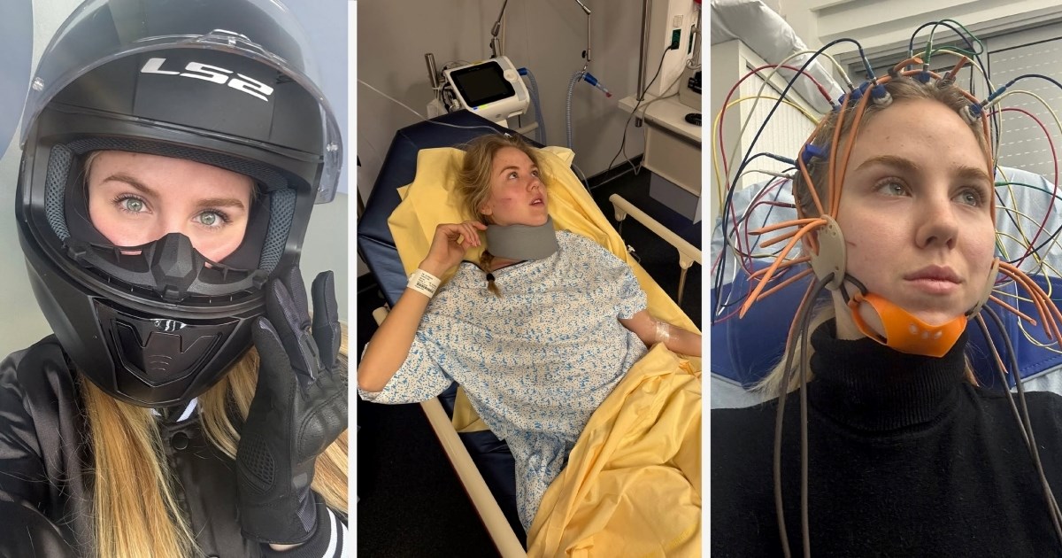 Talijanska princeza doživjela nesreću, reanimirali je: "Glavom sam se zabila u zid"