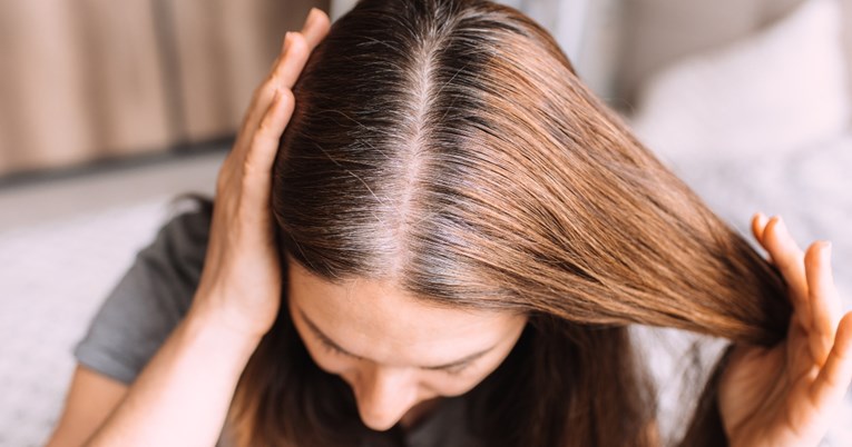 Prerano sijeda kosa mogla bi ukazivati na ove zdravstvene probleme, kažu liječnici