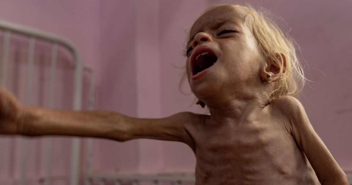 UN: Glad u Gazi je katastrofa, moralna optužnica i neuspjeh čovječanstva