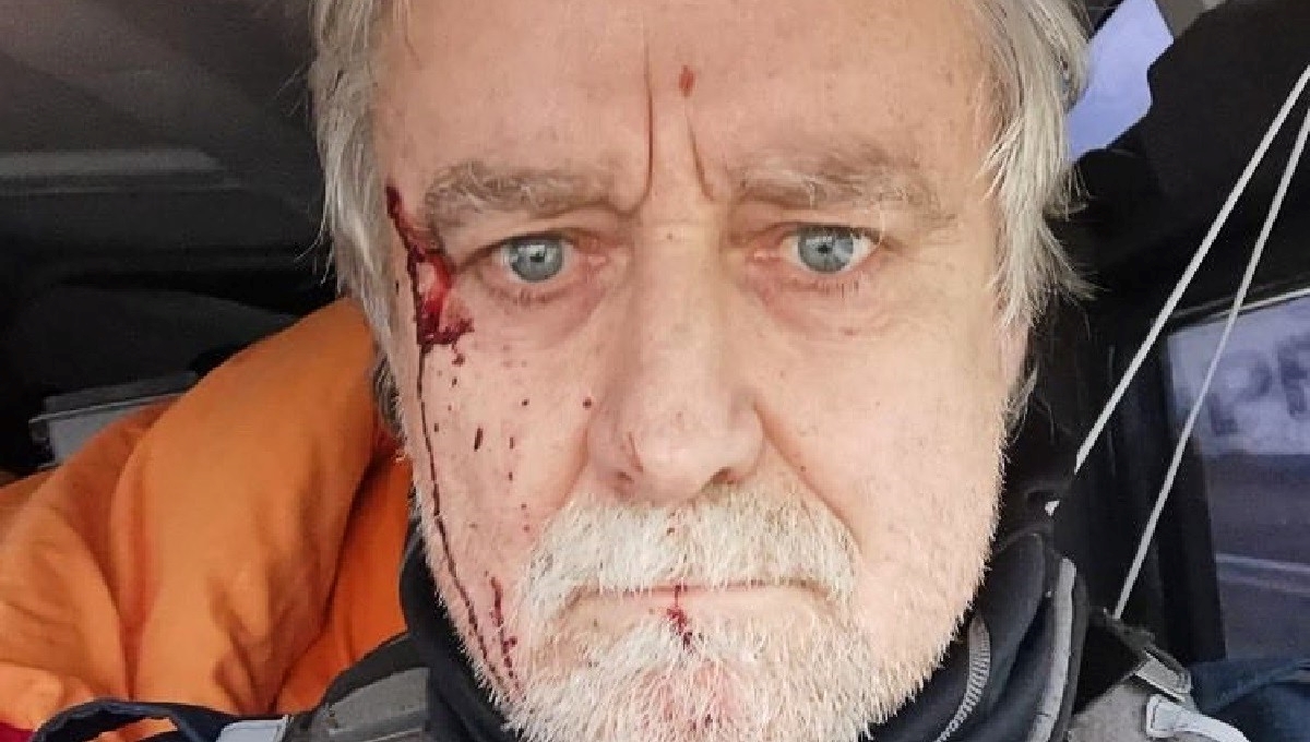 Ukrajinska agencija: Rusi su upucali švicarskog novinara, u bolnici je