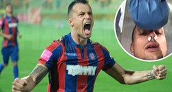 Bivši igrač Hajduka zabio prvijenac pa slomio nos