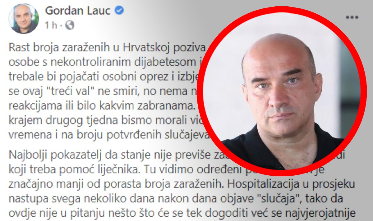 Lauc: Stanje nije previše zabrinjavajuće, to vidimo prema broju ljudi u bolnicama