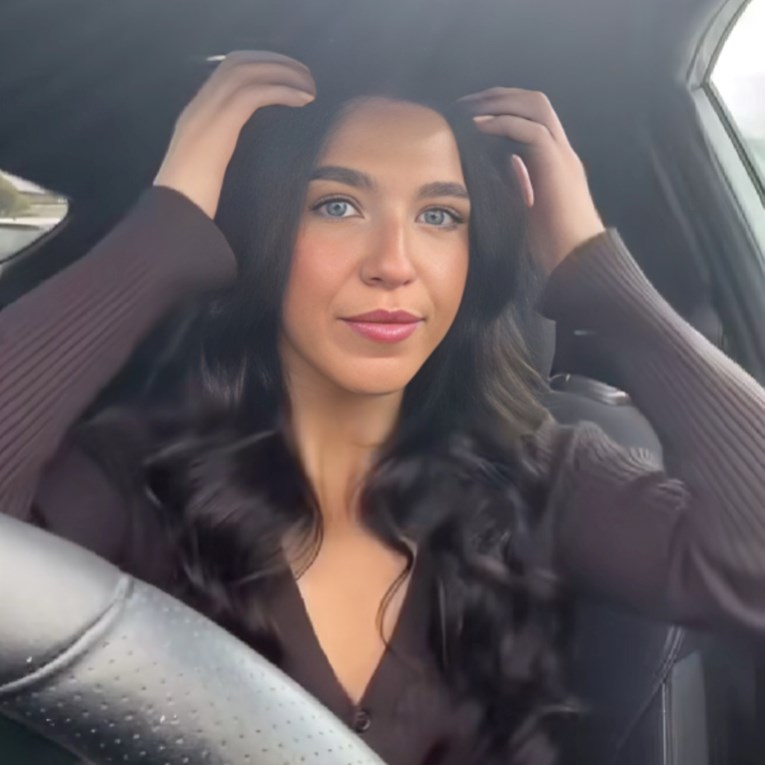 Djevojka skinula ekstenzije za kosu, nije bila spremna na ono što se skrivalo ispod