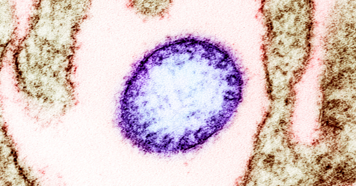 Novi slučajevi virusa Nipah u Indiji. Što je to?