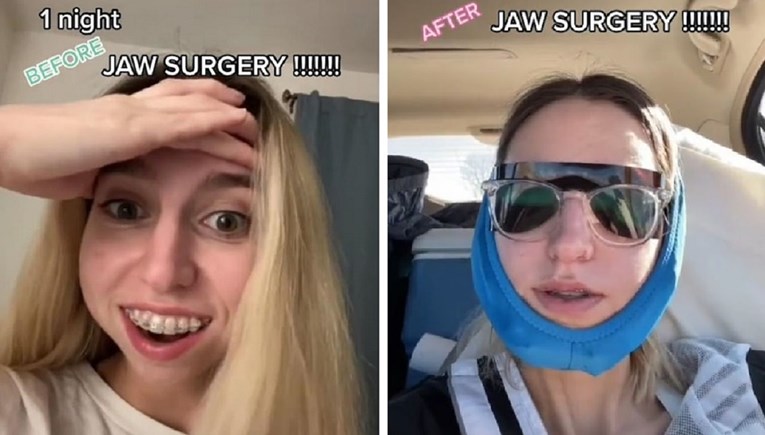 Cura za video prije/poslije operacije čeljusti dobila 8.3 milijuna lajkova