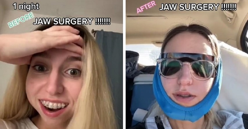 Cura za video prije/poslije operacije čeljusti dobila 8.3 milijuna lajkova