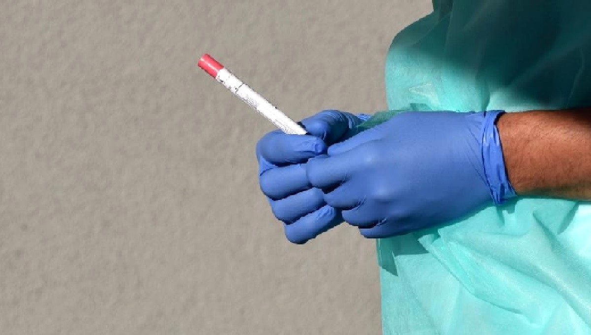 U Varaždinskoj županiji 128 novozaraženih, otvorena nova lokacija za briseve