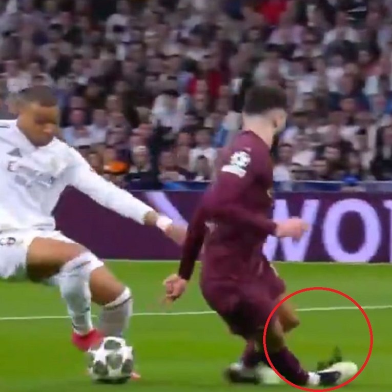 Mbappe je poslao Gvardiola u prazno. Pogledajte gležanj najskupljeg braniča 