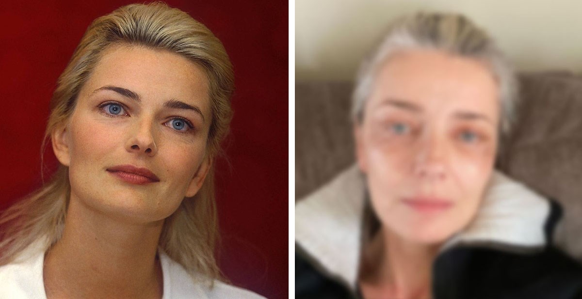 Slavna manekenka (55) pokazala ožiljke nakon estetskog tretmana: Želim biti lijepa