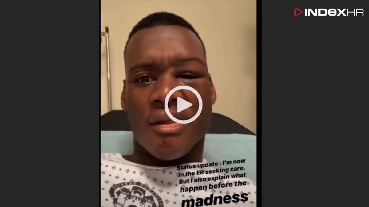 VIDEO Gej crnac pretučen u Zadru: "Jedan me držao, a trojica su me udarala"