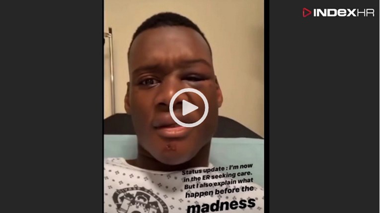 VIDEO Gej crnac pretučen u Zadru: "Jedan me držao, a trojica su me udarala"