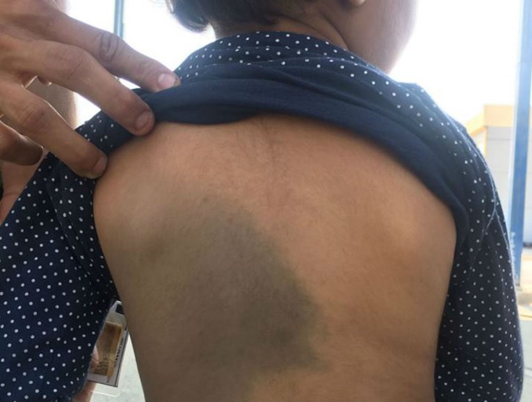 Migrant: Hrvatska policija tukla me dok sam u rukama držao kćer, ozlijeđena je
