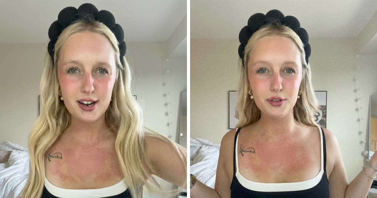 Učenice koriste sjajila za usne kako bi lažirale osip i izbjegle odlazak u školu