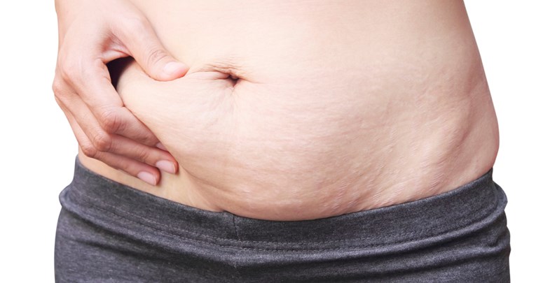 Evo kako brže učvrstiti kožu nakon porođaja ili gubitka kilograma