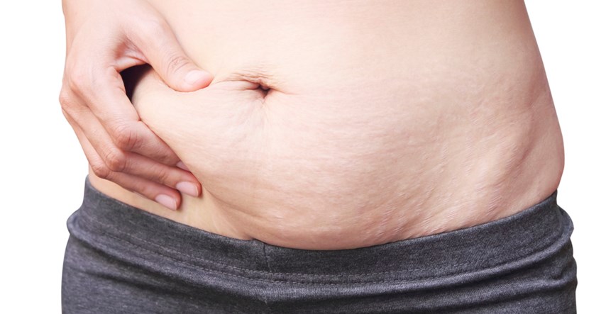 Evo kako brže učvrstiti kožu nakon porođaja ili gubitka kilograma