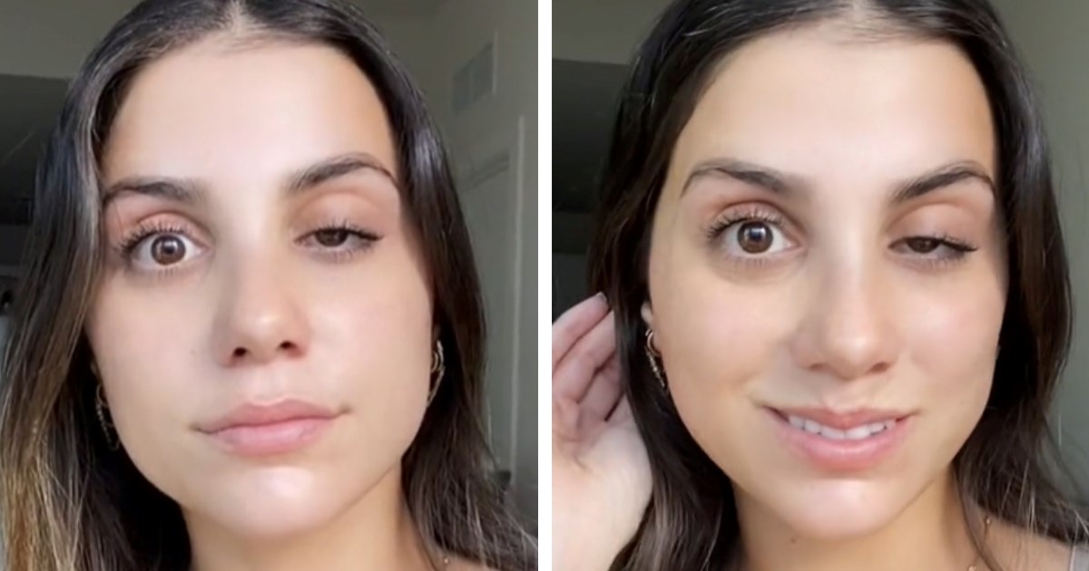 Žena pokazala posljedicu botoksa: Postojalo je samo 1 posto šanse za ovo