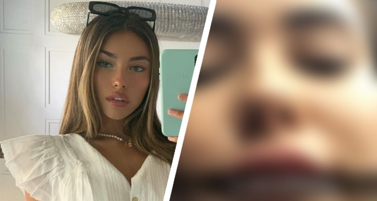 Miljenica tinejdžera pokazala koliko je lažan Instagram: Evo kakva sam zaista