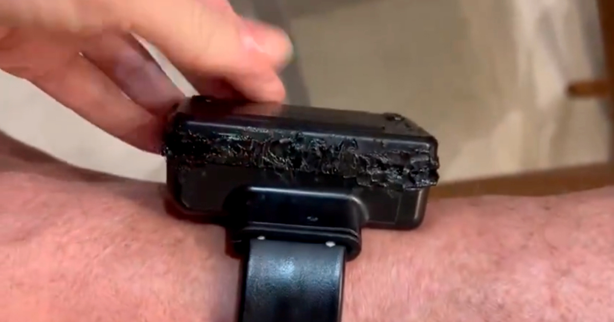 Bolsonaro uhićen jer je lemilicom oštetio nanogicu