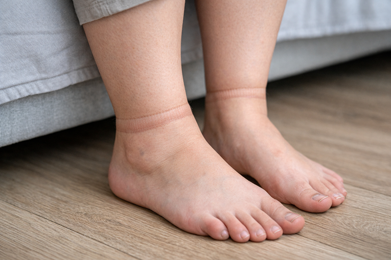 Liječnica: Manje poznati simptom bolesti srca pogoršava se tijekom dana