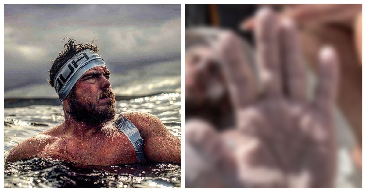 Pokušao preplivati 171 km bez zaustavljanja pa pokazao kako mu izgledaju ruke