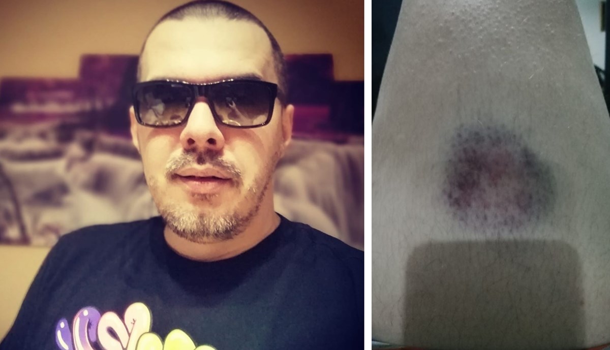 Pjevač tvrdi da ga je policija u Neumu pretukla zbog pjesme: "Tamo nas većina mrzi"