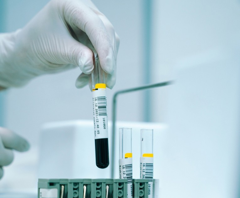 Otkrivene neobične četverolančane DNA strukture u ljudskoj krvi