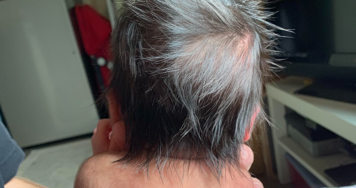 Beba rođena sa sijedom kosom: "2020. je toliko stresna da se i bebe rađaju sijede"