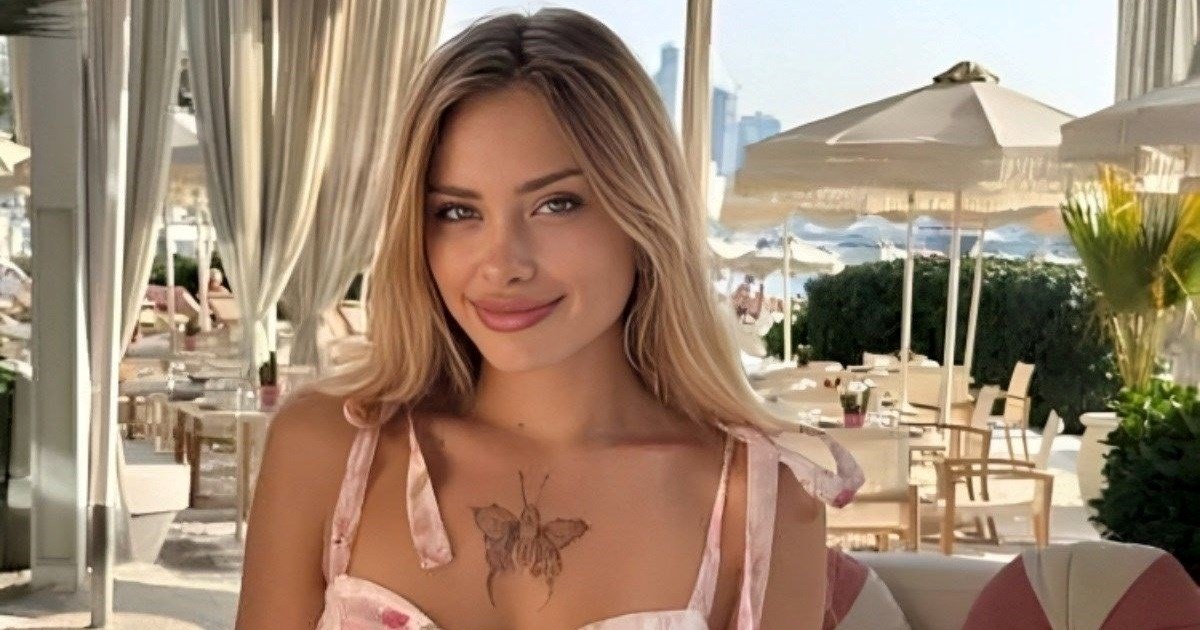 VIDEO Ukrajinska manekenka prvi put progovorila o brutalnom napadu u Dubaiju