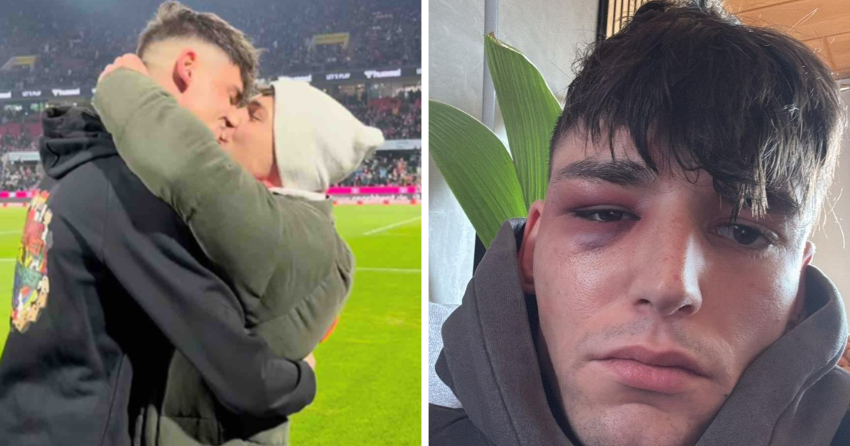 Pretučen sudac koji je zaprosio dečka pred 50.000 gledatelja u Bundesligi