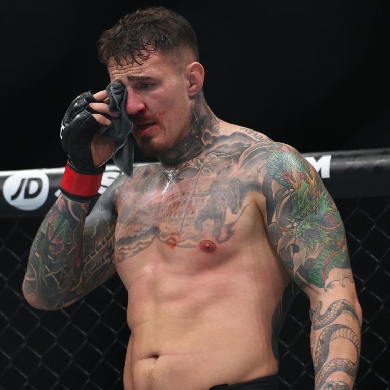 Aspinall otkrio što se događa s njegovim okom nakon uboda