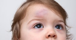 Bolničarka otkriva kako prepoznati da dijete treba hitnu pomoć nakon udarca u glavu