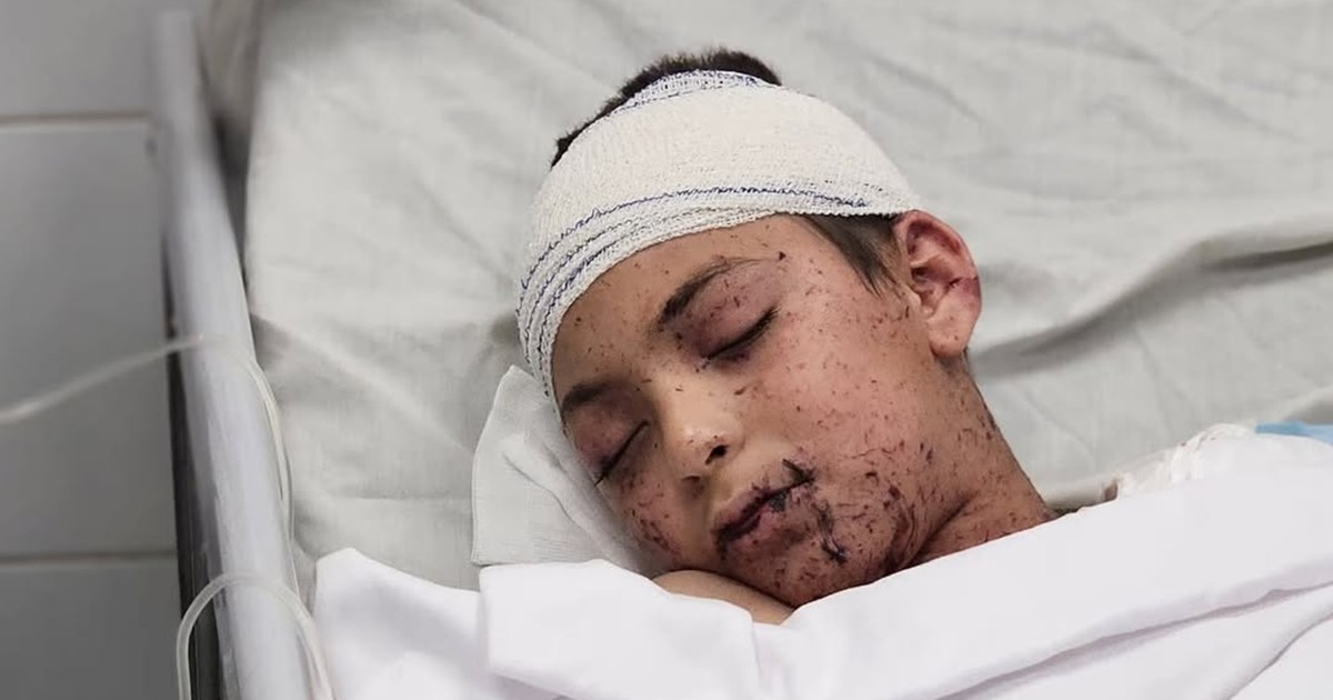 Italija nudi liječenje dječaku koji je izgubio braću i sestre u izraelskom napadu