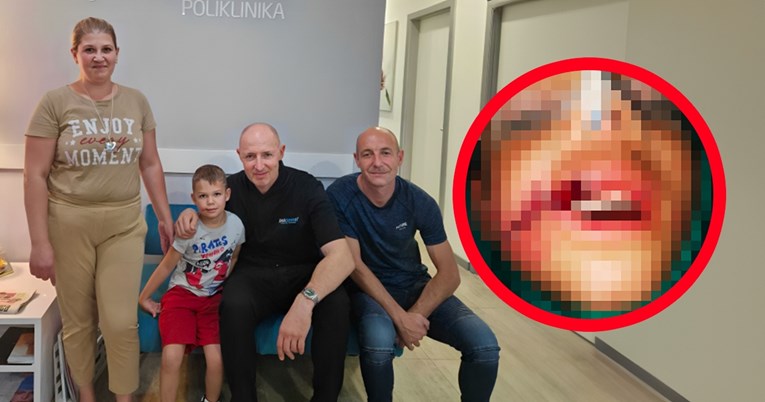 Zagrebački doktor besplatno će sanirati ožiljak na licu dječaka kojeg je ugrizao pas