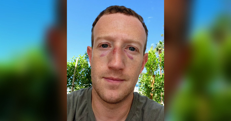 Mark Zuckerberg osvanuo s ozljedom i masnicama ispod očiju. Evo što se dogodilo