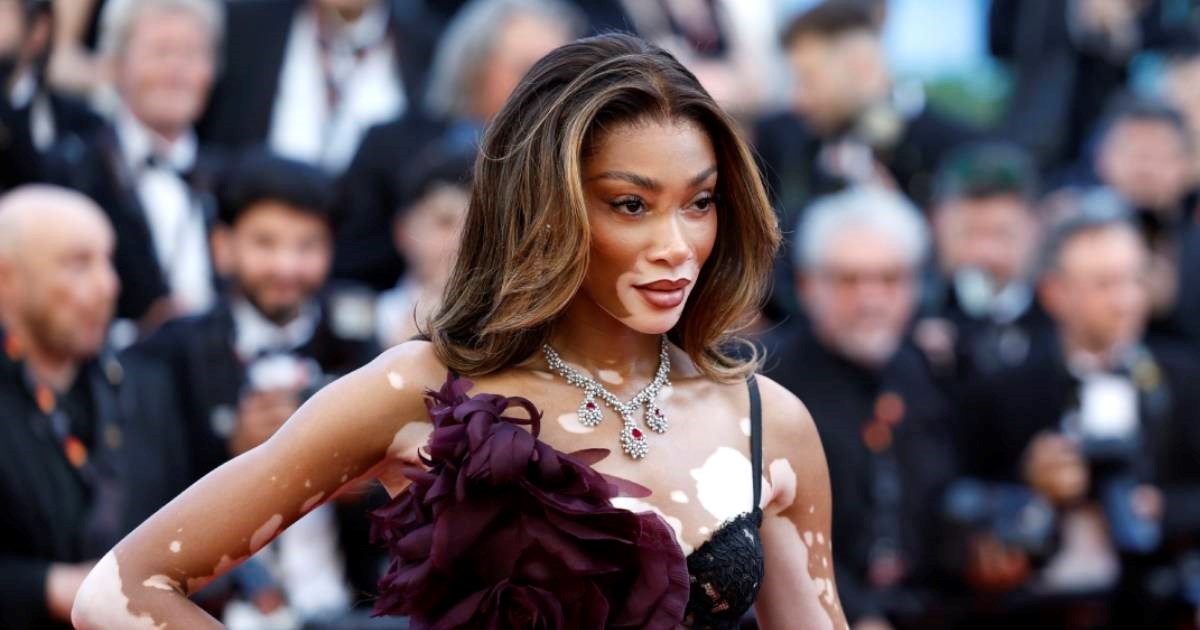 Od djevojčice koju su zadirkivali do jedne od najpoznatijih manekenki na svijetu