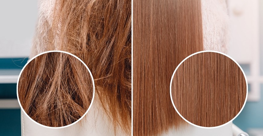 Prepoznajte je li vaša kosa zdrava uz ova 4 jednostavna kućna testa