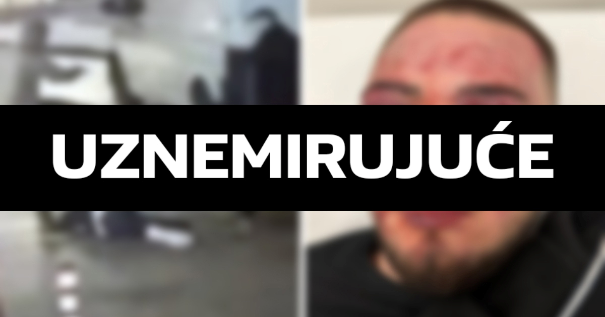 Uhićen i drugi napadač na maloljetnika u Rijeci. Ima 33 godine