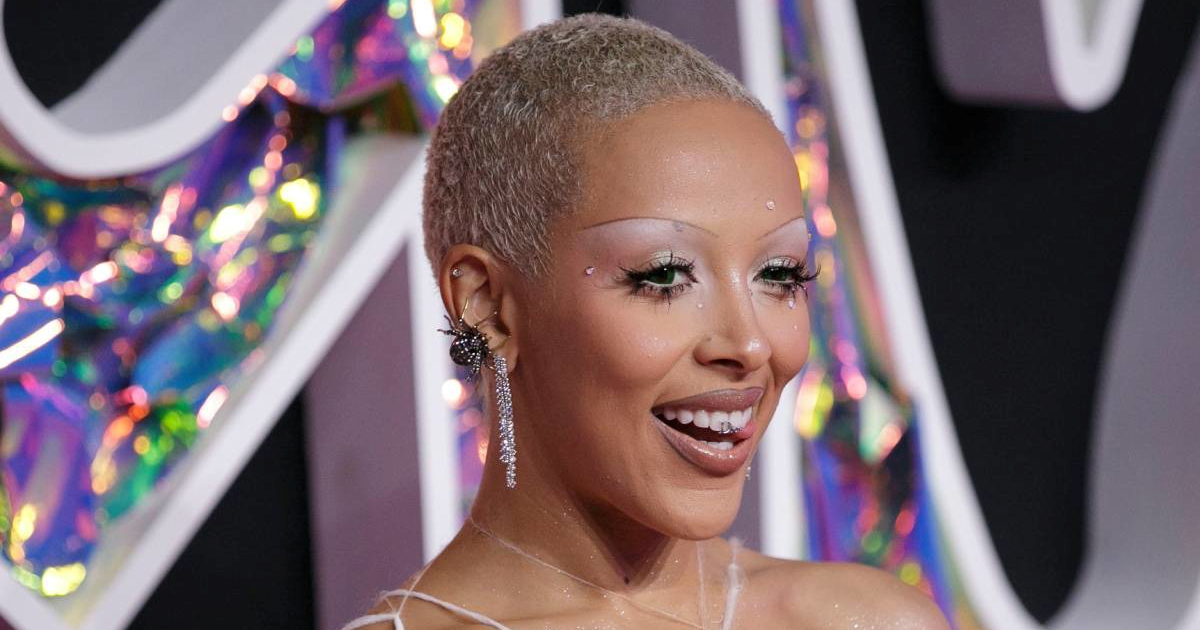 Doja Cat: Dijagnosticiran mi je granični poremećaj osobnosti