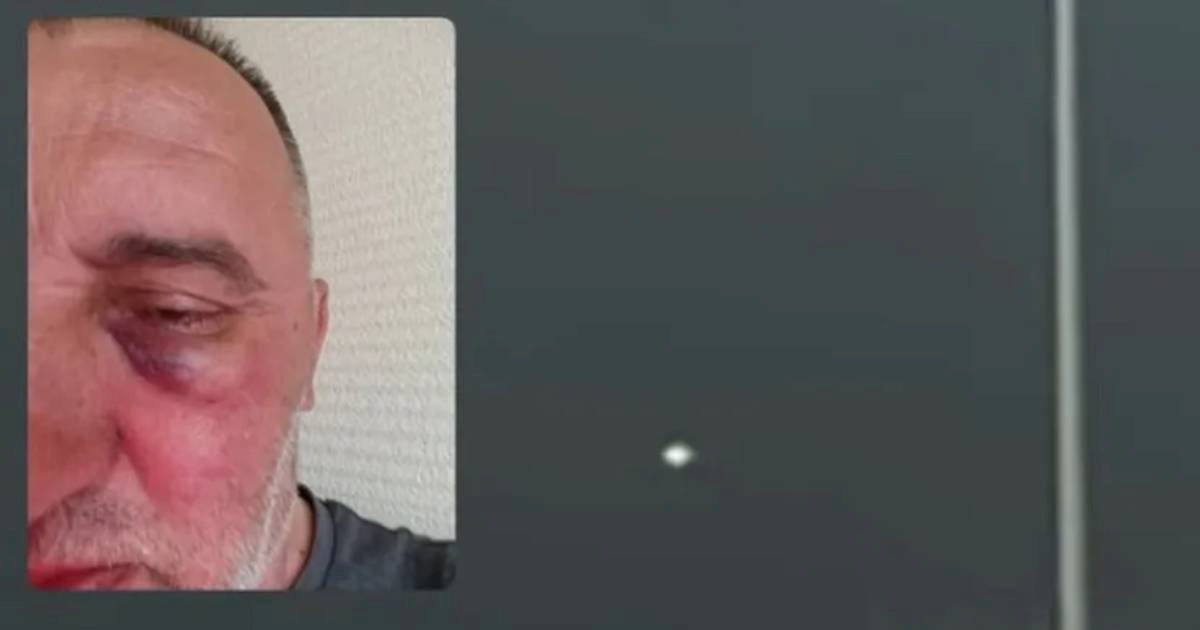 Srpski klub iz BiH tvrdi da su igrači Željezničara pretukli njihova fotografa