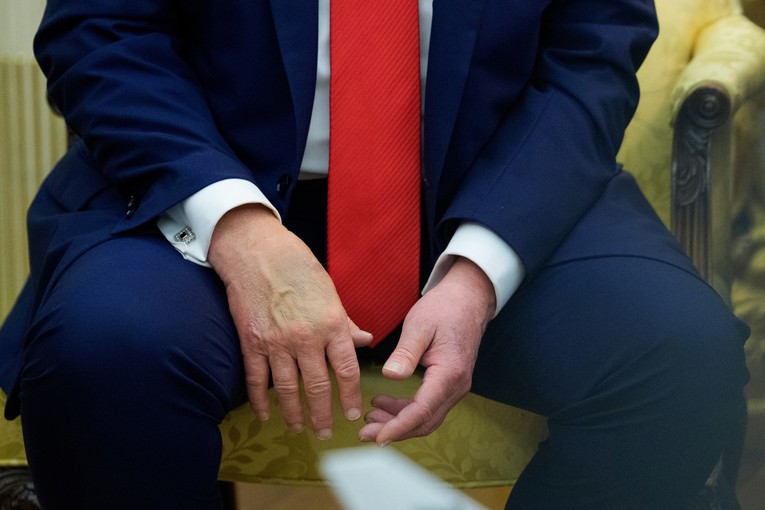 Trump (79) ide na liječnički pregled, internetom se i dalje šire fotografije modrica